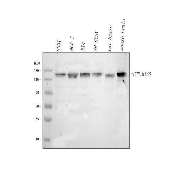  Western blot analysis of PPP1R13B using anti-PPP1R13B antibody (A07257-2)
