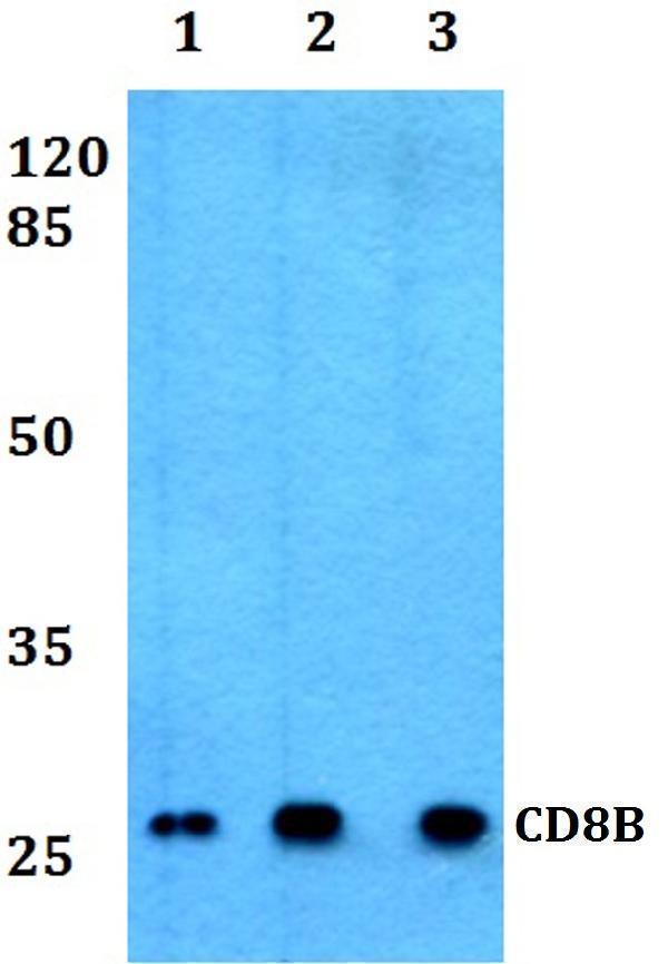 Western blot (WB) analysis of CD8B polyclonal antibody at 1:500 dilution
Lane1:Jurkat whole cell lysate
Lane2:Raw264