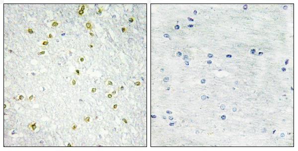 Immunohistochemistry analysis of paraffin-embedded human brain tissue, using SNAPC5 Antibody