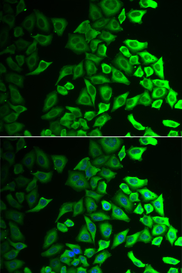 Immunofluorescence analysis of A549 cell using IL18BP antibody
