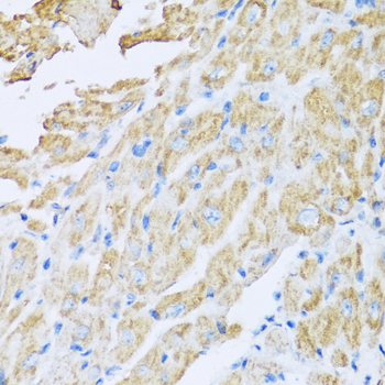 Immunohistochemistry of paraffin-embedded mouse heart using IL18BP antibody at dilution of 1:100 (40x lens)