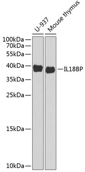 Western blot analysis of extracts of various cell lines, using IL18BP antibody