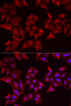 a07264 pcbd1 primary antiboties if testing 2