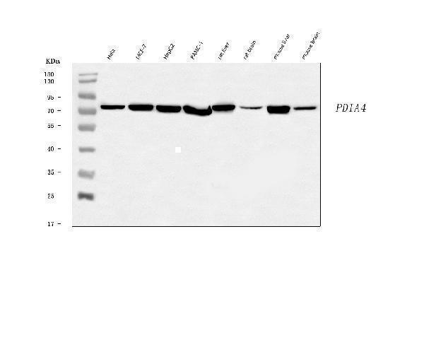  Western blot analysis of ERp72/PDIA4 using anti-ERp72/PDIA4 antibody (A07267-1)