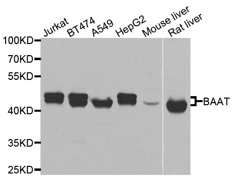 Western blot analysis of extracts of various cells, using BAAT antibody