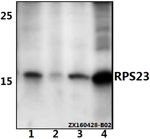 Western blot (WB) analysis of RPS23 polyclonal antibody at 1:500 dilution
Lane1:Hela whole cell lysate(40ug)
Lane2:HEK293T whole cell lysate(40ug)
Lane3:SP2/0 whole cell lysate(40ug)
Lane4:PC12 whole cell lysate(40ug)