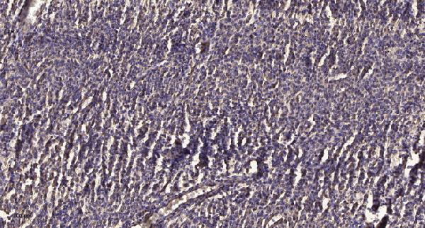 Immunohistochemical analysis of paraffin-embedded human meningioma