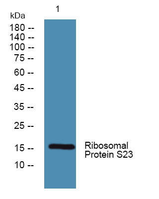 Western blot analysis of lysates from HCT116 cells, primary antibody was diluted at 1:1000, 4°over night