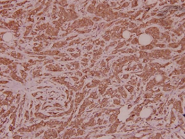 a07281 1 spin1 primary antiboties ihc testing 2