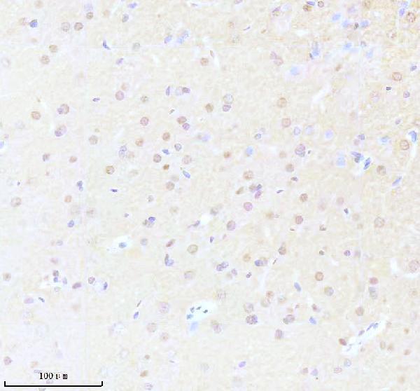IHC analysis of SPIN1 using anti-SPIN1 antibody (A07281-2)