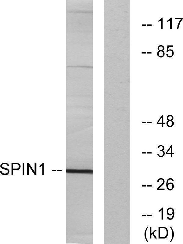Western blot analysis of lysates from HeLa cells, using SPIN1 Antibody