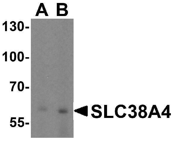 a07283 slc38a4 primary antibodies wb testing 1
