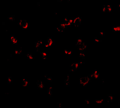 Immunofluorescence of BICD1 in Daudi cells with BICD1 antibody at 20 μg/mL