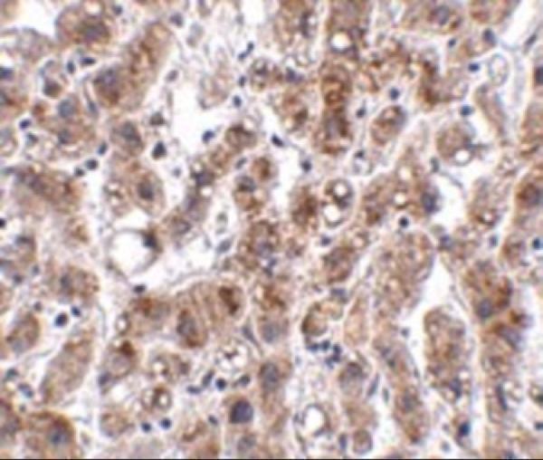 a07288 1 acot13 primary antibodies ihc testing 2
