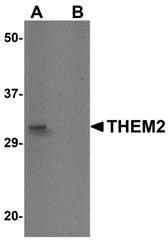 a07288 1 acot13 primary antibodies wb testing 1