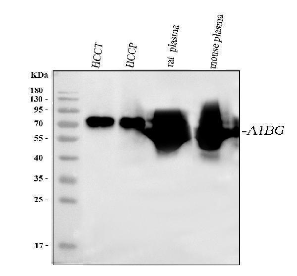  Western blot analysis of Alpha 1B-Glycoprotein/A1BG using anti-Alpha 1B-Glycoprotein/A1BG antibody (A07289-2)