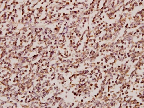 a07291 1 srsf4 primary antiboties ihc testing 2