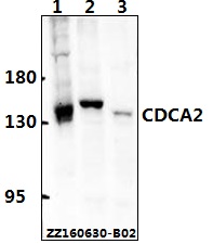 a07293 1 cdca2 primary antiboties wb testing 1