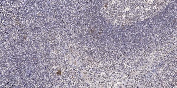 a07293 2 cdca2 primary antibodies ihc testing 1