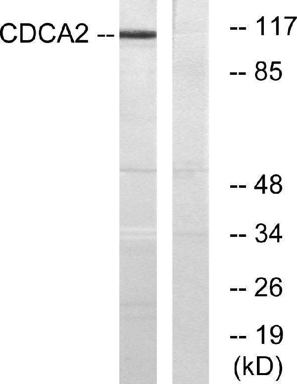 a07293 2 cdca2 primary antibodies wb testing 3