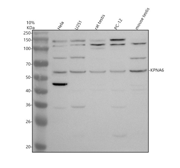 Western blot analysis of KPNA6 using anti-KPNA6 antibody (A07295-2)