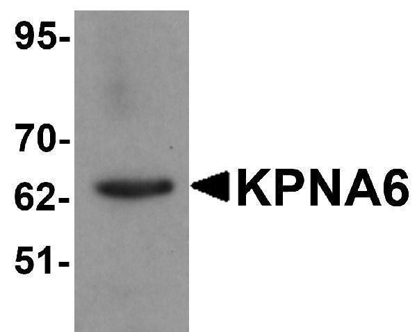 Western blot analysis of KPNA6 in 293 cell lysate with KPNA6 antibody at 1 μg/mL