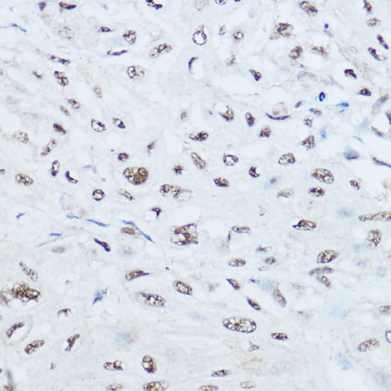 a07296 srrm1 primary antiboties ihc testing 2