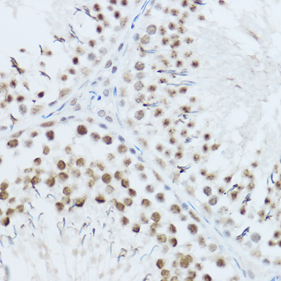 a07296 srrm1 primary antiboties ihc testing 3