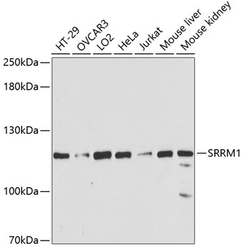 a07296 srrm1 primary antiboties wb testing 1