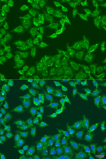 Immunofluorescence analysis of U2OS cells using ADAP1 antibody  at dilution of 1:100