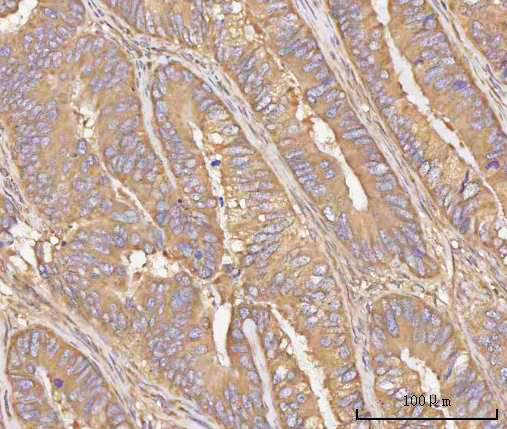  IHC analysis of PPP3CB using anti-PPP3CB antibody (A07303-1)