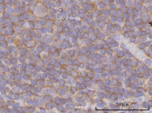  IHC analysis of PPP3CB using anti-PPP3CB antibody (A07303-1)