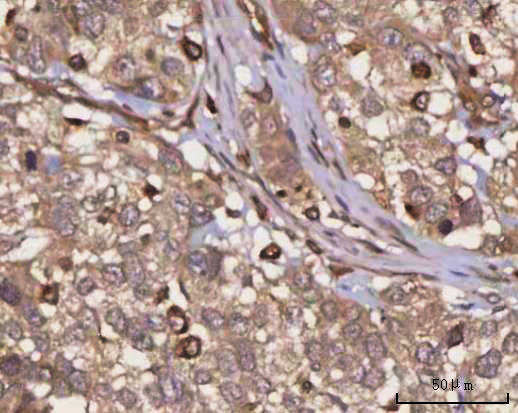 a07303 1 ppp3cb primary antibodies ihc testing 4