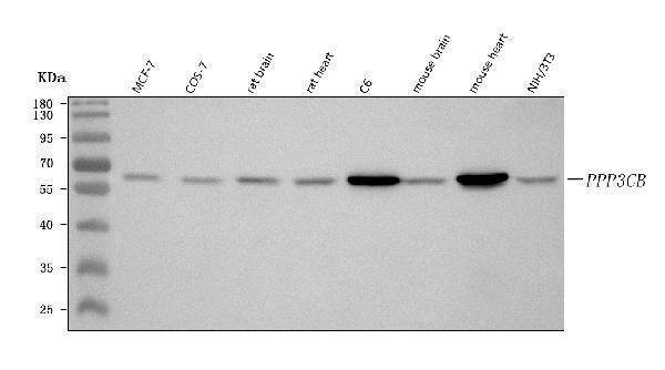  Western blot analysis of PPP3CB using anti-PPP3CB antibody (A07303-1)