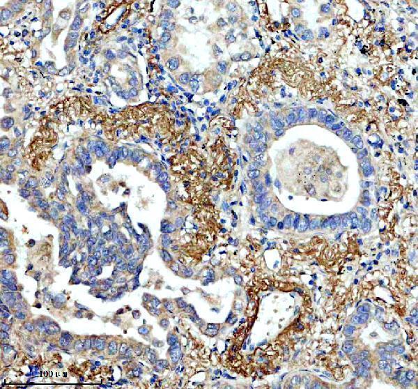 a07304 1 fbln2 primary antibodies ihc testing 1