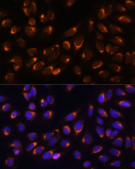 Immunofluorescence analysis of U-2 OS cells using NUCB1 Polyclonal Antibody  at dilution of 1:100 