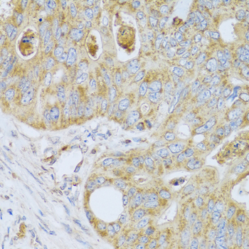 a07308 1 psg1 primary antiboties ihc testing 2