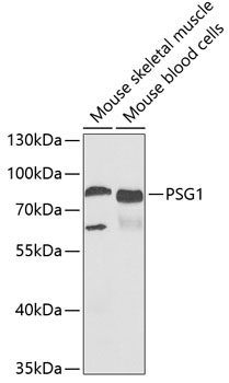 a07308 1 psg1 primary antiboties wb testing 1