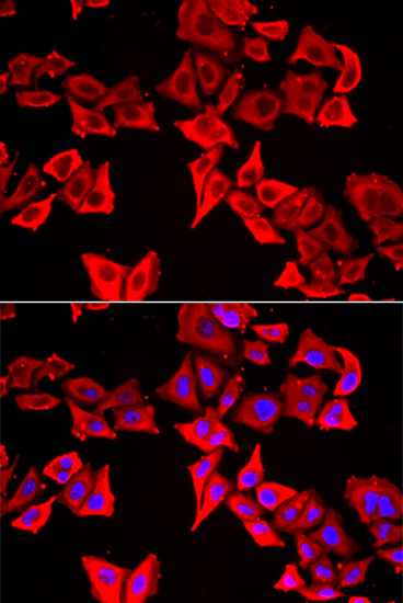 Immunofluorescence analysis of MCF7 cells using THRSP antibody 