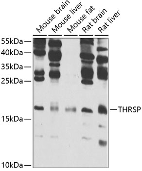 Western blot analysis of extracts of various cell lines, using THRSP antibody  at 1:1000 dilution