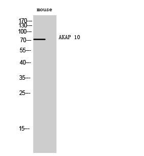 Western blotting validation for Anti-AKAP 10 Antibody A07311-1
Western Blot (WB) analysis of mouse cells using AKAP 10 polyclonal antibody