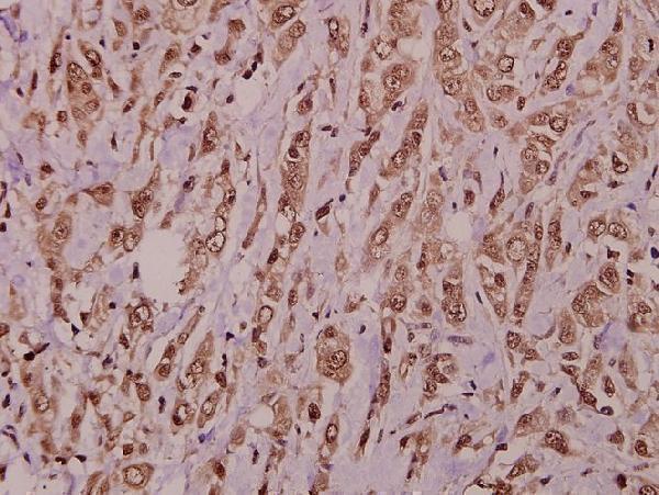 a07311 akap10 primary antiboties ihc testing 2