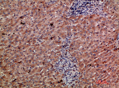 Immunohistochemistry validation of CLEC4C using Anti-CD303 CLEC4C Antibody (A07313)