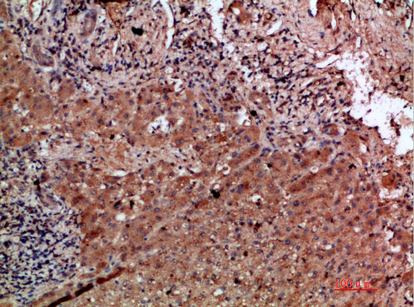 Immunohistochemistry validation of CLEC4C using Anti-CD303 CLEC4C Antibody (A07313)