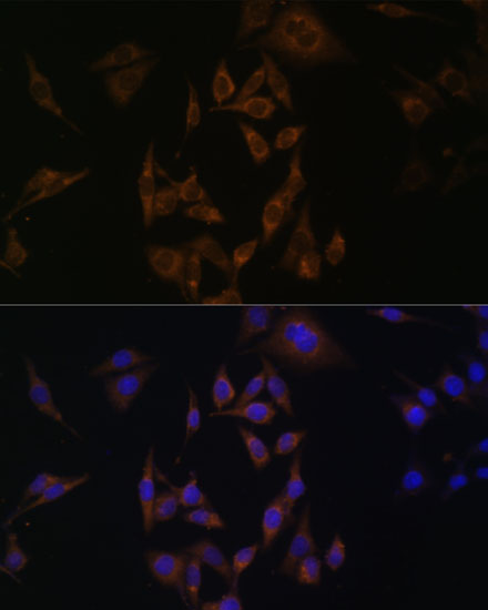 a07315 ube2l6 primary antiboties if testing 2