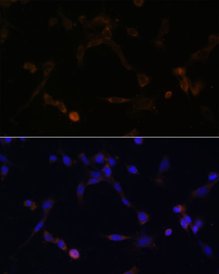 a07315 ube2l6 primary antiboties if testing 3
