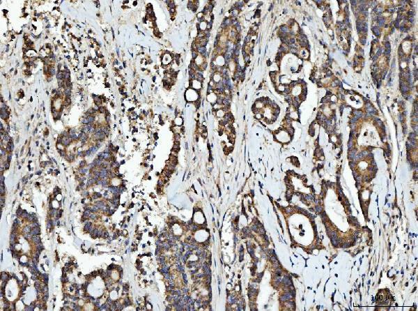  IHC analysis of RGS12 using anti-RGS12 antibody (A07317-2)