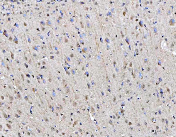  IHC analysis of RGS12 using anti-RGS12 antibody (A07317-2)