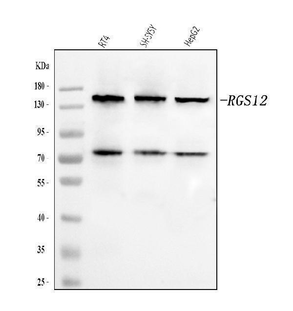  Western blot analysis of RGS12 using anti-RGS12 antibody (A07317-2)