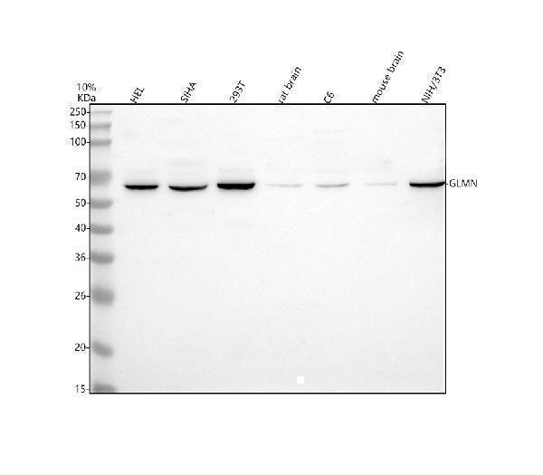  Western blot analysis of GLMN using anti-GLMN antibody (A07319-1)